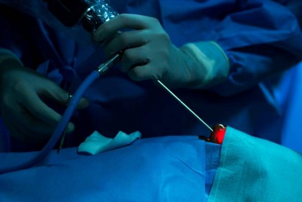 Eνδοσκοπική διαρρινική χειρουργική υπόφυσης και βάσης κρανίου