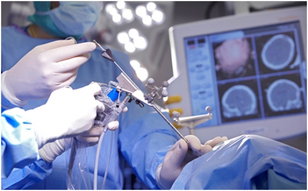 Διακρανιακή διακοιλιακή ενδοσκοπική νευροχειρουργική